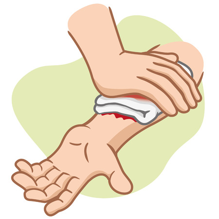 Illustration of an arm receiving first aid injury compression arm. Ideal for medical supplies educational and institutionalのイラスト素材