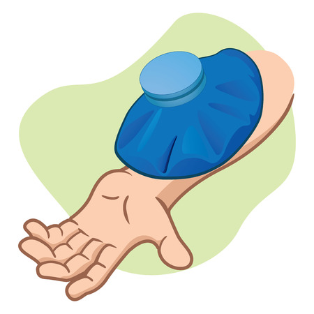 Illustration First Aid person's arm with thermal bag. Ideal for catalogs, informative and medical guidesのイラスト素材