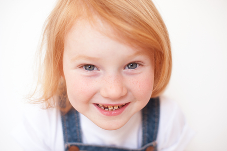 Beautiful red-haired girl with freckles and caries