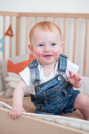 Child with atopic dermatitis in the cribの写真素材