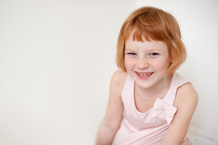 Portrait of a redhead smiling girl with dental caries with copyspaceの写真素材