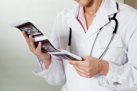 Radiologist Holding Ultrasound Printの写真素材
