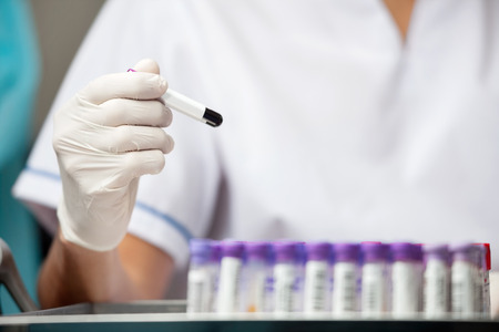 Midsection of male researcher analyzing sample in laboratoryの写真素材