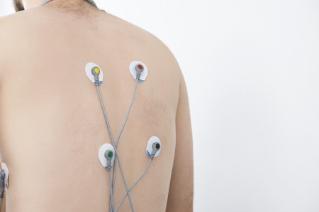Patient With Electrostimulator Electrodes Attached On Backの写真素材