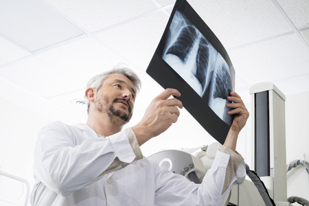 Male Radiologist Analyzing Chest X-ray In Examination Roomの写真素材