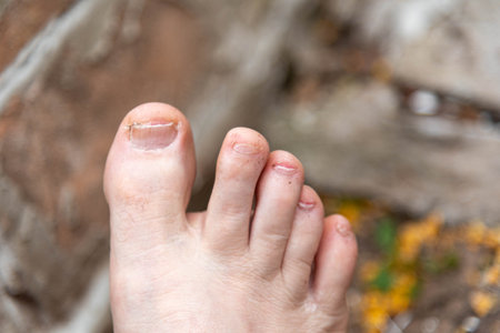 Human feet with uneven nails. Selective focus. anatomy. Feet.