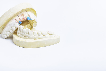 Plaster cast of teeth with space for your textsの写真素材