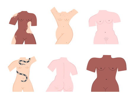 Set of different naked female bodies. Body positive. All women are beautiful. Vitiligo, pigmentation, cellulite, thinness, plus size. Trendy style. Design for postcard, clothing, cover, banner Vectorのイラスト素材