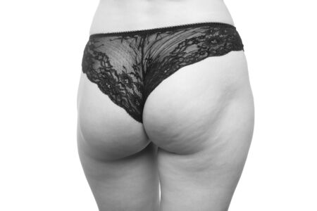 oversized female buttocks with cellulite on white background isolated, monochromeの写真素材