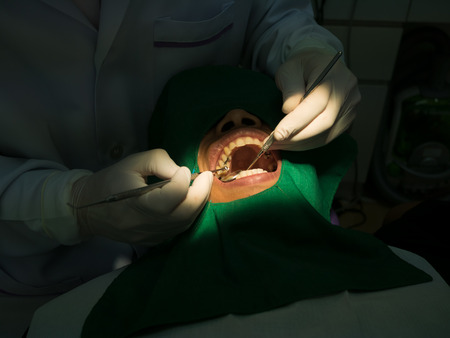 female patient having her teeth examined by specialist and dentist filling her teeth の写真素材