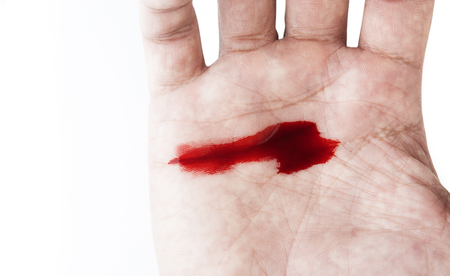 Hand of man injured wound from accident and blood bleeding on white background , insurance conceptの写真素材