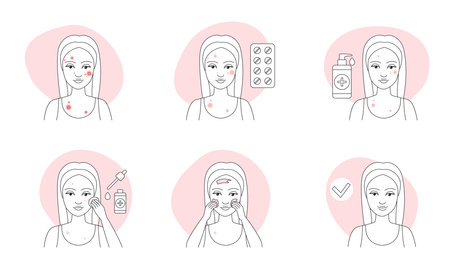 Acne treatment, thin line infographic icons set vector illustration. Outline skincare medical procedures, peeling and medicines for oily skin problems, blotch, pimple and inflammation diseaseのイラスト素材