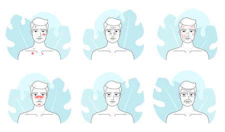 Male skin problem line icons set vector illustration. Outline man different types of medical skin troubles collection, dark circle under eyes and wrinkles, acne and melasma, blackheads and rosaceaのイラスト素材
