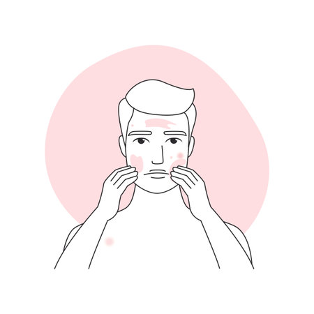 Man with acne inflammation on face skin applying cosmetic cream with massage vector illustrationのイラスト素材
