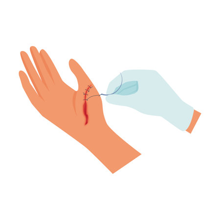 Doctors hand in surgical glove sewing up open wound on patients arm vector illustrationのイラスト素材