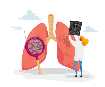 Pulmonology Specialist, Professional Doctor Character Holding X-ray Image of Lungs Learning Patient Fluorography with Tuberculosis or Pneumonia Disease, Medical Staff Work. Cartoon Vector Illustrationのイラスト素材