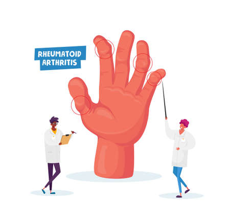 Rheumatoid Arthritis. Doctor Arthrologist Pointing on Huge Hand with Joints Disease, Nurse with Clip Board, Conciliumのイラスト素材
