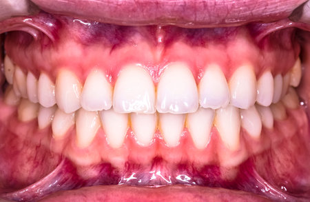 Picture of the woman jaw macro. Macro, picture.