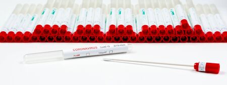 Swabs, Covid-19 PCR test Coronavirusの写真素材