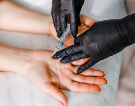 Injections into women's palms in a modern beauty salon. The concept of health care and self-care.の写真素材
