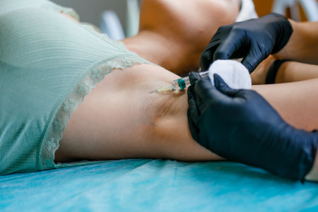 Cosmetic Injections for Armpit Beauty Enhancement at Salon.の写真素材