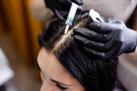 Woman Receiving Hair Restoration Injections at Beauty Salon.の写真素材