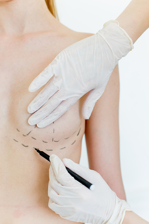 Plastic surgeon at workの写真素材