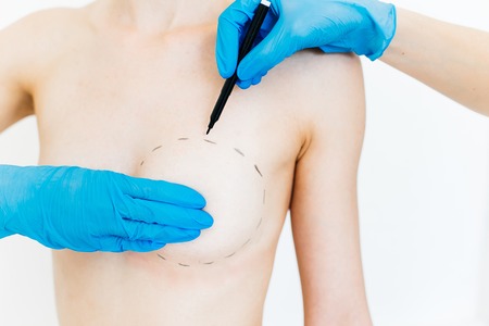 Plastic surgeon at workの写真素材