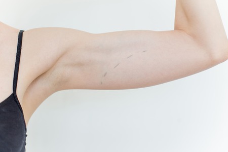 Plastic surgeon drawing marks on a womanの写真素材