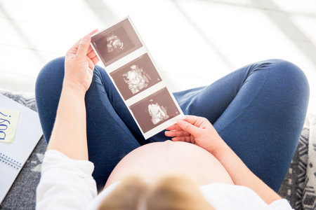 Pregnant woman holding ultrasound image of her future babyの写真素材