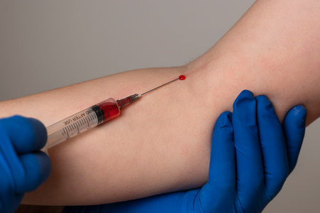 doctor in blue medical gloves takes blood from a vein from a patient