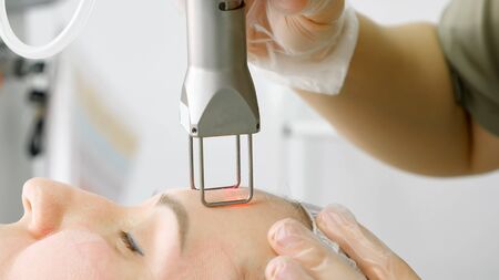 pretty lady patient lies on white couch and beauty salon therapist makes laser hair removal on face extreme close viewの写真素材