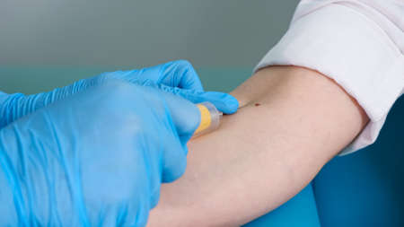 Skilled nurse in blue gloves takes blood specimen from man patient vein with syringe in contemporary hospital office extreme close viewの写真素材