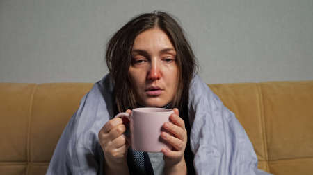 Young woman with long hair and runny nose falls ill and drinks hot tea from mug wrapped in warm blanket, sitting on comfortable sofa in living room.の写真素材