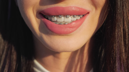 Young woman with dark hair smiles at the camera. Lady has plump lips with pink lipstick and braces...