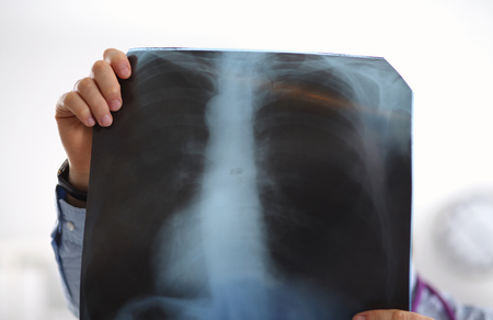 close up of male doctor holding x-ray or roentgen image.の写真素材