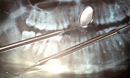 Dental tools lying on the x-ray .の写真素材