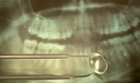 a dental x-ray film isolated on white.の写真素材