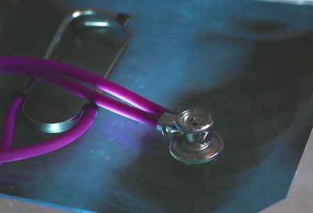 Medical stethoscope lying on an x-ray. Close-upの写真素材