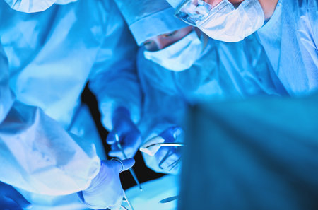 Surgery team in the operating roomの写真素材