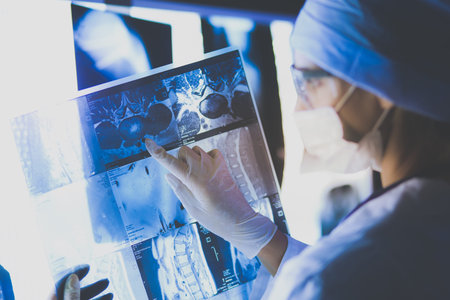 Two female women medical doctors looking at x-rays in a hospitalの写真素材