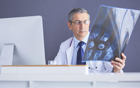 close up of male doctor holding x-ray or roentgen image