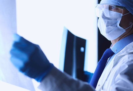 Young doctor looking X-Ray image on isolated white backgroundの写真素材