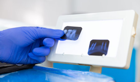 Dentist's Office: Dentist's X-Ray Of Teeth