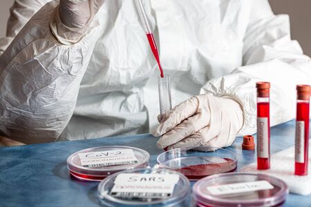 bio scientist experimenting with a variety of viruses to create Covid-19 diseaseの写真素材