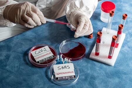 bio scientist experimenting with a variety of viruses to create Covid-19 diseaseの写真素材