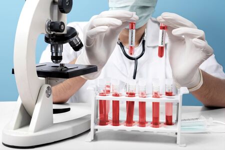 Doctor man in protective gloves with microscope holding test tubes with a coronavirus blood sample....
