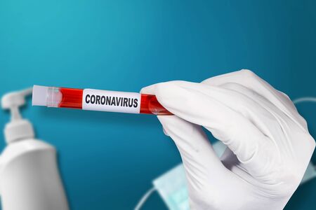 Doctor man in protective gloves holding a test tube with a coronavirus blood sample. Prevent flu disease Coronavirusの写真素材