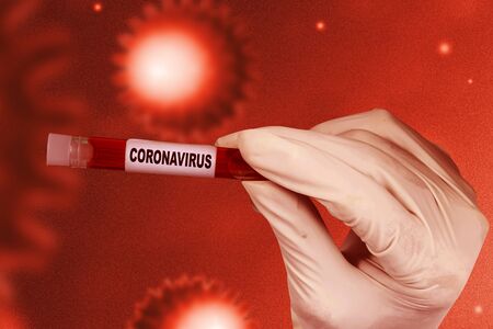 Doctor man in protective gloves holding a test tube with a coronavirus blood sample. Prevent flu...