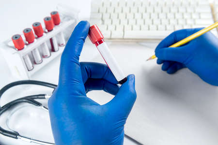 The researcher analyzing medical tube and write the report on the desk
